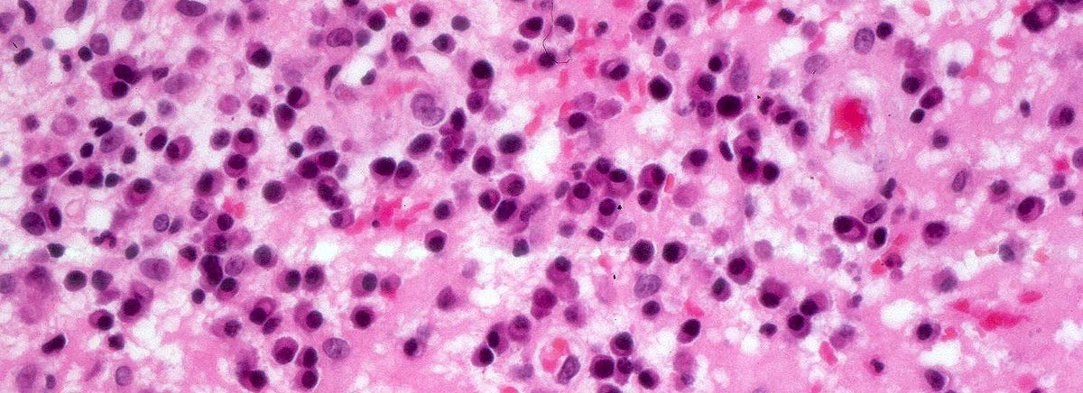 infezioni ospedaliere
