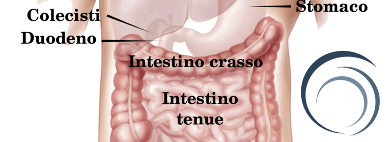 perforazione intestinale