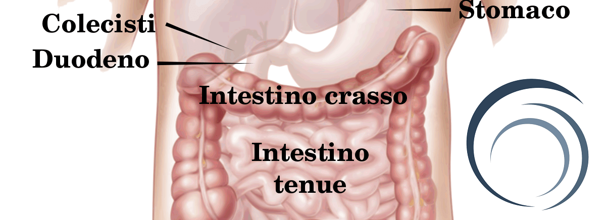 perforazione intestinale