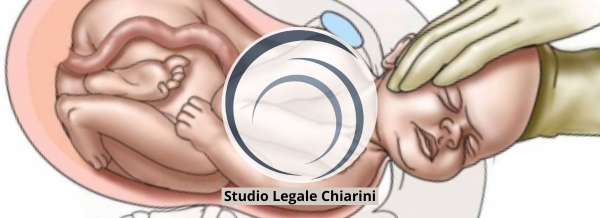 Fascia Per Braccio In Rete Con Cinghia In Vita - Supporto Per Lesioni A Spalla, Gomito E Fratture - Regolabile Uomo/Donna